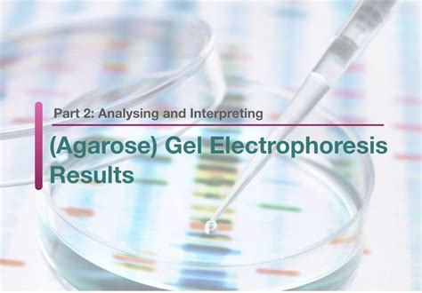 Part 2: Analysing and Interpreting (Agarose) Gel .